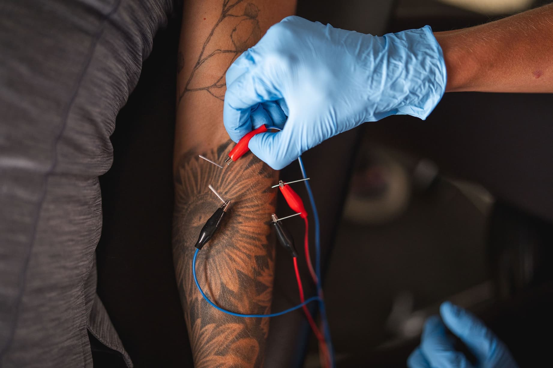 Expert dry needling evaluation and treatment